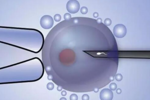 2026年国内正规借卵试管费用指南：供卵代怀与代生助孕价格清单